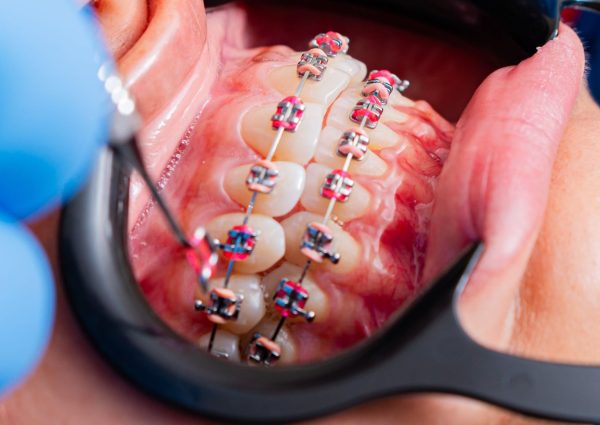 orthodontics orthodontics
